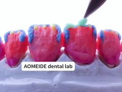 Festigkeit Natürliche Ästhetik Massivzirkonie Krone perfekt für Einzel- oder Mehrzahnzähne