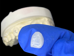 IPS e.max Furniere für den Schneidblatt im Farbton A1 Natürliche Ästhetik für ein makelloses Lächeln