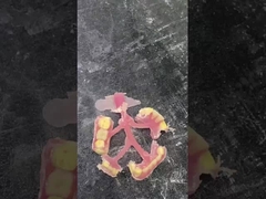 Nesbit Flexible Partial Prothese für Komfort und Langlebigkeit beim Zahnersatz