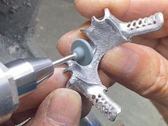 Teilprothese gegossen