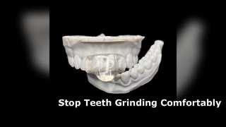 Custom Mini Night Guard for Teeth Grinding and Bruxism