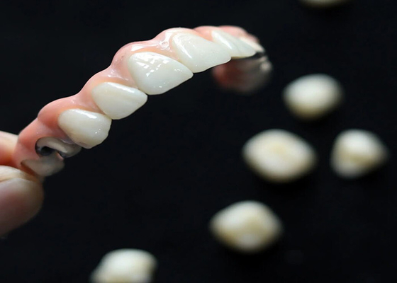 kaufen Ästhetische Lösung Zahnimplantate Kronenbrücke für Erwachsene fehlende Zähne ersetzen online manufacture