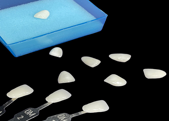 kaufen Porzellan Emax Veneer Durchsichtigkeitsbindung für präzise ästhetische Restaurierungen online manufacture