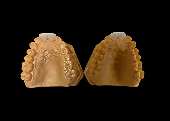 kaufen Perfekt für vordere und hintere Zähne angepasste ästhetische Zirkonia-Zahnkrone online manufacture