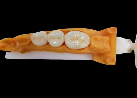 kaufen Verschleißbeständige Zirkonia Zahnkrone mit Splitter- und Fleckenbeständigkeit und natürlicher Ästhetik aus dem chinesischen Zahnlabor online manufacture