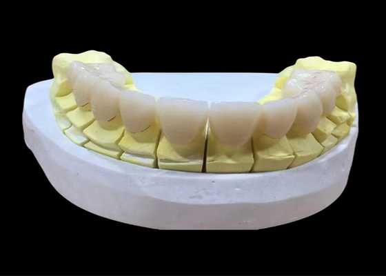kaufen Zirkonia Porzellan Zahnkrone mit ästhetischem und natürlichem Aussehen online manufacture