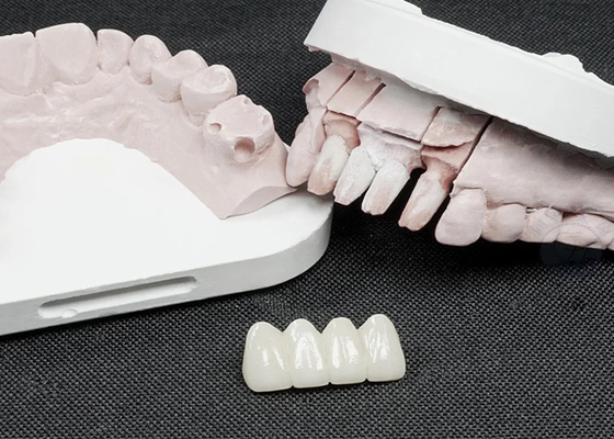 kaufen Premium Zirkonia Zahnkronen für höhere Festigkeit und natürliche Ästhetik online manufacture
