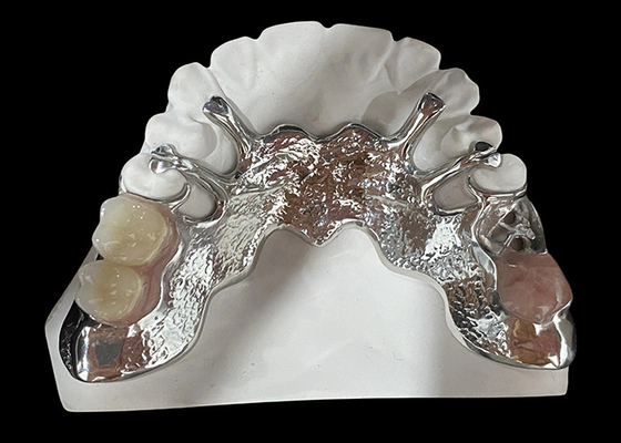kaufen Anpassungsfähiger Guss-Teilentfernbarer Zahnersatz mit Acrylharz / Metallbasis online manufacture
