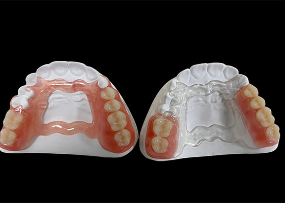 kaufen Teilweise abnehmbare Zahnprothese, abnehmbare Zahnprothese zum Kauen und Sprechen online manufacture