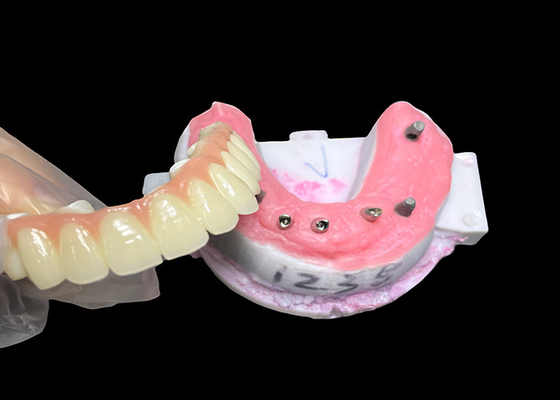 kaufen Implantatgestützte Vollbogenprothese Fest Implantat Keramikkronenbrücke online manufacture
