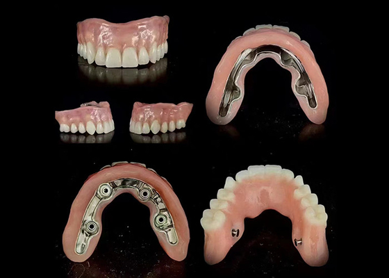kaufen Präzise Stange Implantat unterstützt Hybrid-Denture sichere Passform verstellbare Stabilität online manufacture