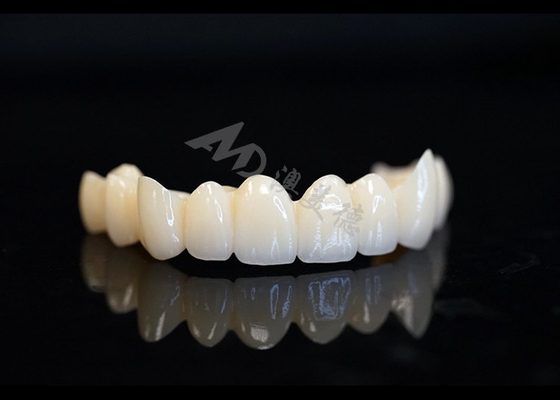 kaufen Präzisionsgefertigte Zirkonia-Krone für perfekte Zahnfit und Komfort online manufacture