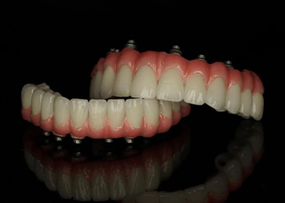 kaufen Titanium-Basis-Fest-Implantat-gestützte Zahnersatz mit Keramikkronenbrücke zum Ersetzen fehlender Zähne online manufacture