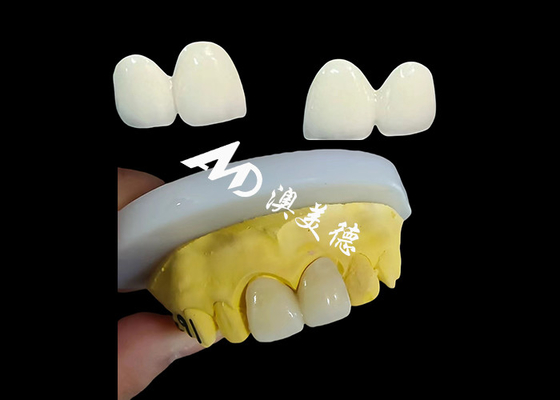 kaufen Custom Zirkonia Zahnkrone Präzise Fit Zahnkappe aus dem chinesischen Zahnlabor online manufacture