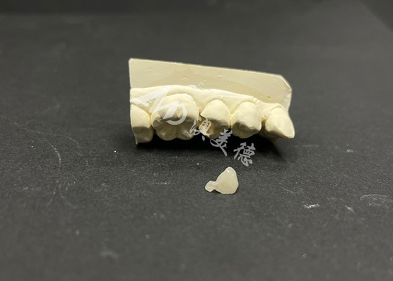 kaufen Hypoallergene, fleckenbeständige Emax-Keramik-Inlay zur genauen Reparatur beschädigter Zähne online manufacture