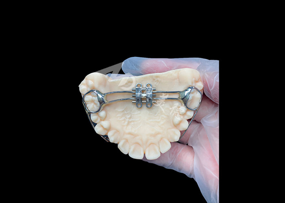kaufen MSE-Palatenexpanzer Innovative kieferorthopädische Geräte zur effektiven Zahnausrichtung online manufacture