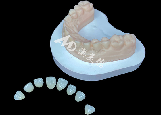 kaufen IPS e.max Veneer Premium ästhetische Lösung für atemberaubende Lächeln Transformationen online manufacture