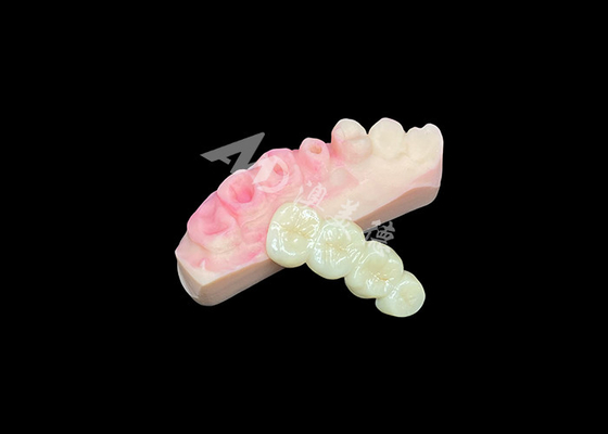 kaufen Überlegene Massivzirkonie-Kronenbrücke für eine natürliche Zahnästhetik online manufacture