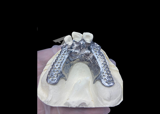 kaufen Einfache Anpassung Custom Cast Partial Denture Stabiler und natürlich aussehender Rahmen für schnelle Ergebnisse online manufacture