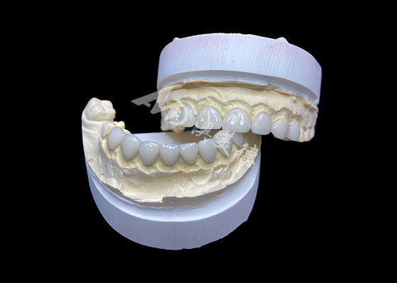 kaufen Anpassung Ultra Dünne Glas-Keramik Veneers Hohe Transluzenz online manufacture