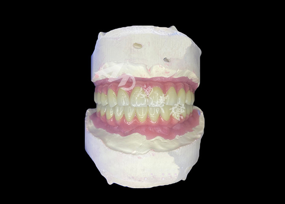 kaufen All-on-6 Zahnimplantate mit Stabilität und Komfort online manufacture