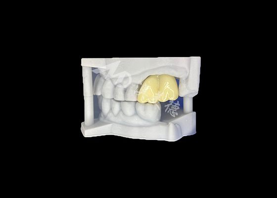 kaufen Feste Zirkonia Zahnkrone Langlebige Haltbarkeit Garantierte Molar aus China Zahnlabor online manufacture