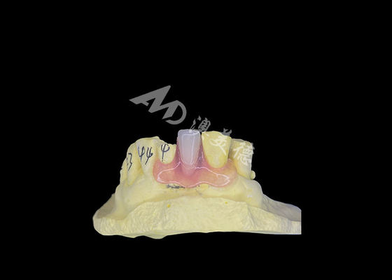 kaufen Nesbit Flexible Partial Prothese für Komfort und Langlebigkeit beim Zahnersatz online manufacture