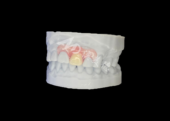 kaufen Individuell angepasste Nesbit Flexible Partial Prothese für natürliche Passform und langlebigen Komfort online manufacture