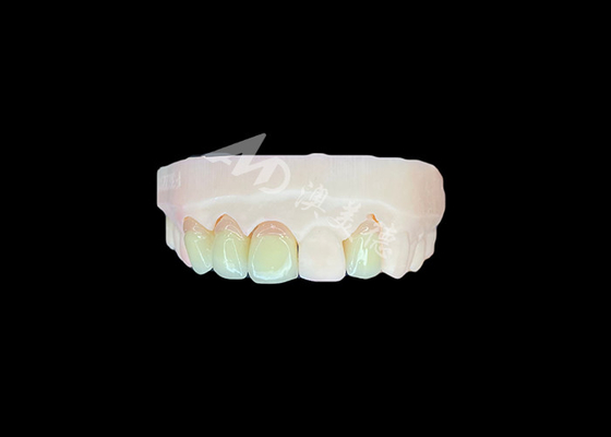 kaufen Natürliche und komfortable Passform Zirkonia Porzellankrone China Zahnlabor anpassbarer Farbton online manufacture
