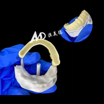 kaufen Provisorische PMMA-Implantatbrücke mit hohler Innenseite für Stabilität und natürliche Heilung, hochpräzise CAD/CAM-Fertigung, biokompatibles PMMA-Material online manufacture