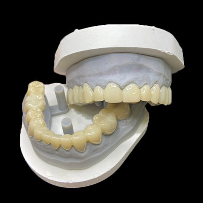 kaufen PMMA Temporary Restorations CAD/CAM PMMA Crowns and Bridges for Provisional Dental Cases online manufacture
