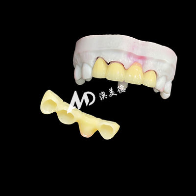kaufen Premium Ceramic Crowns and Bridges for High-Strength, Natural Aesthetics and Long-Lasting Clinical Performance online manufacture