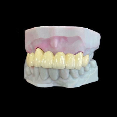 kaufen Porzellan mit einem Co-Cr-Rahmen online manufacture