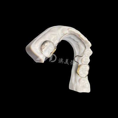 kaufen Speziell angepasster Sprachbogen mit Banden Orthopädisches Gerät zur Raumpflege und Zahnausrichtung online manufacture