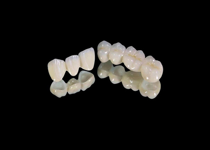Verschleißbeständige Zirkonia Zahnkrone mit Splitter- und Fleckenbeständigkeit und natürlicher Ästhetik aus dem chinesischen Zahnlabor