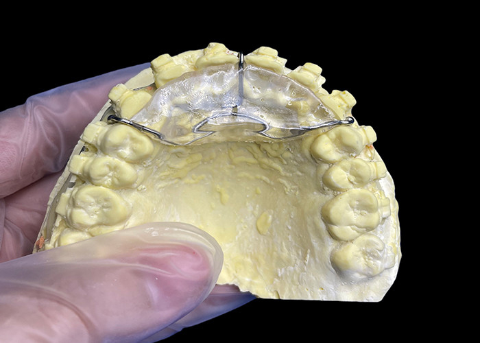 Custom Made Orthodontic Appliances Beißfläche für korrekte Beißprobleme oder in TMJ, um den Druck auf das Kiefergelenk zu lindern.