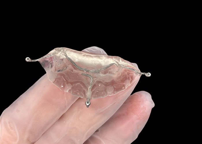 Custom Made Orthodontic Appliances Beißfläche für korrekte Beißprobleme oder in TMJ, um den Druck auf das Kiefergelenk zu lindern.