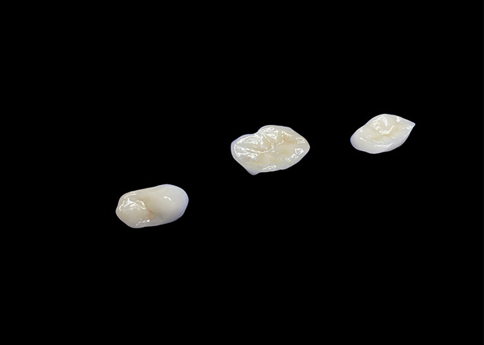 Biokompatible keramische Inlays und Onlays, die für eine komfortable Haltbarkeit und nahtlose Integration in natürliche Zähne konzipiert sind