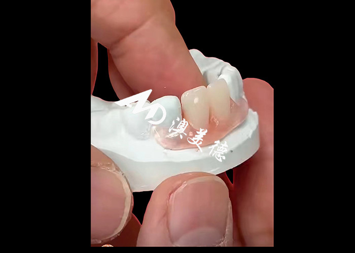 Flexible Zahnersatzzähne von Nesbite bieten eine nahtlose Lösung für ein komfortables und natürliches Lächeln