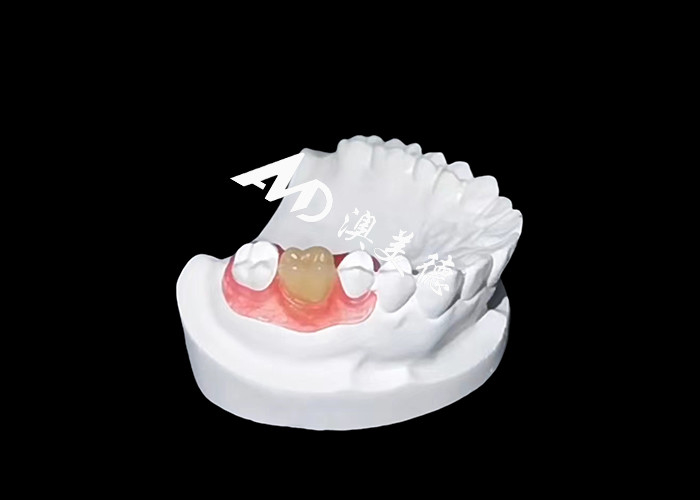 Flexible Zahnersatzzähne von Nesbite bieten eine nahtlose Lösung für ein komfortables und natürliches Lächeln