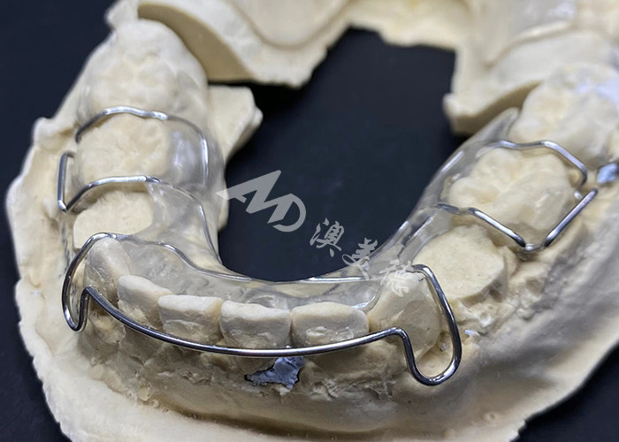 Komfortabel zu tragen Der Hawley-Halter des AMD-Zahnlabors für eine sichere und gesunde Kieferorthopädie