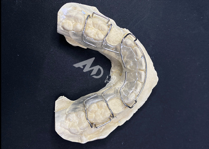 Hawley-Retiner Orthodontikgeräte zur komfortablen Korrektur der Zahnausrichtung