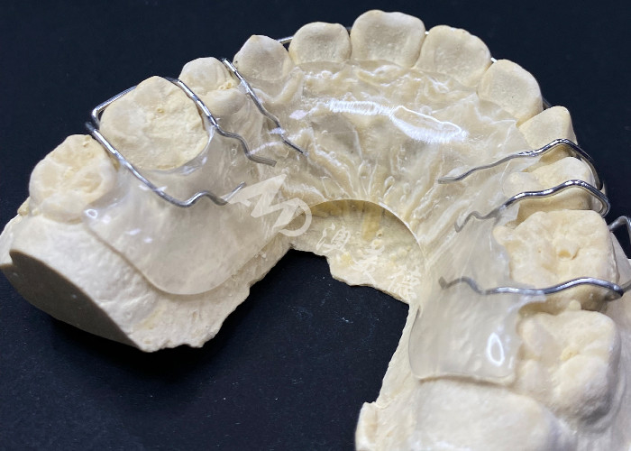 Hawley-Retiner Orthodontikgeräte zur komfortablen Korrektur der Zahnausrichtung