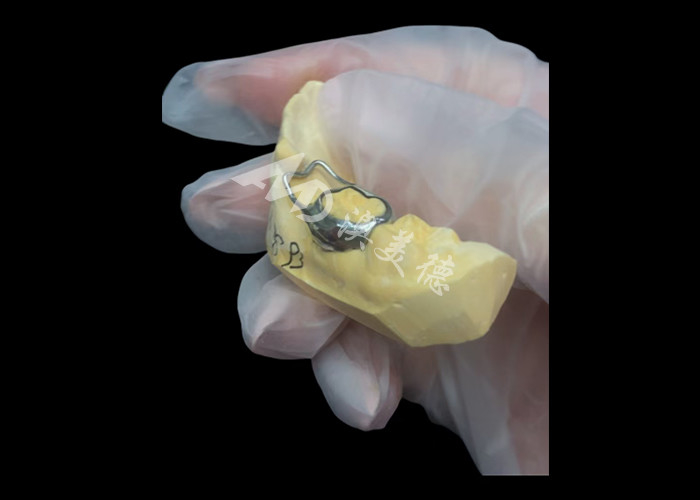 Orthodontic Space Maintainer ist ein unbezahlbares Gerät, das die Zahnlücke von Kindern geschickt schützt und eine ordnungsgemäße Zahnentwicklung gewährleistet.