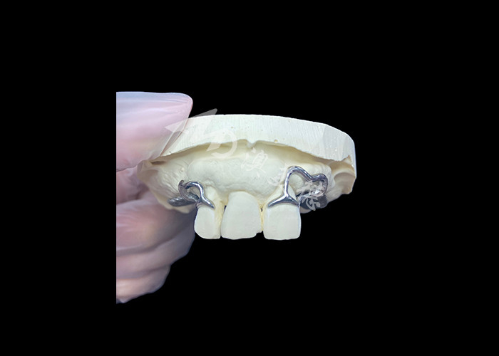 Einfache Anpassung Custom Cast Partial Denture Stabiler und natürlich aussehender Rahmen für schnelle Ergebnisse