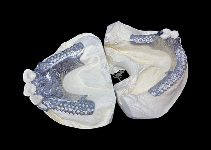 Einfache Anpassung Custom Cast Partial Denture Stabiler und natürlich aussehender Rahmen für schnelle Ergebnisse