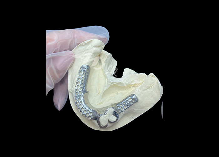Einfache Anpassung Custom Cast Partial Denture Stabiler und natürlich aussehender Rahmen für schnelle Ergebnisse