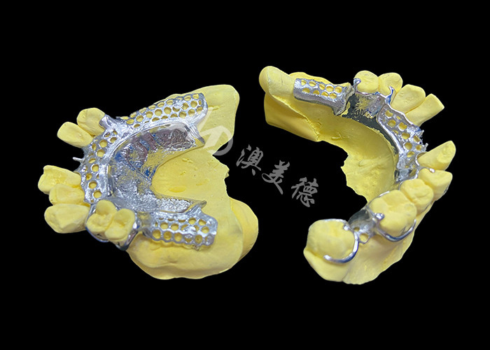 Custom Cast Partial Denture natürliche Lösung für mehr Komfort und Sprache