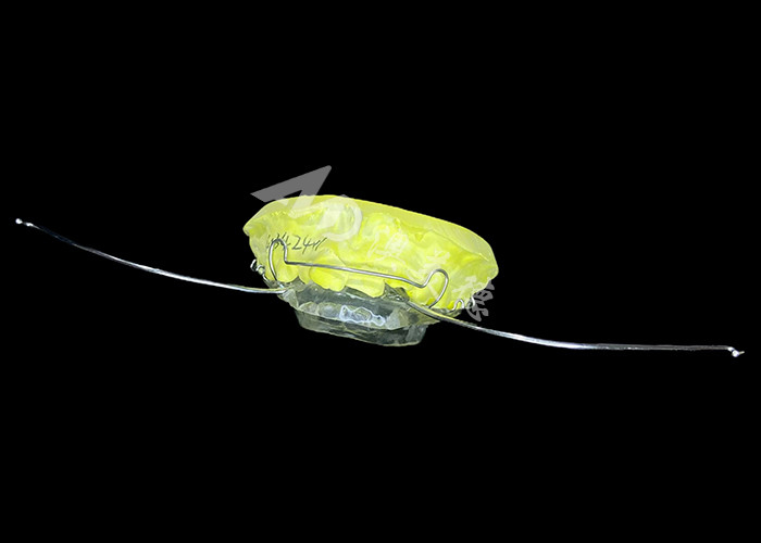 Ästhetische Kieferorthopädie Modifizierter Aktivierer Dauerhaltiges Material für eine effektive Kieferausrichtung