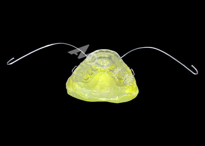 Ästhetische Kieferorthopädie Modifizierter Aktivierer Dauerhaltiges Material für eine effektive Kieferausrichtung